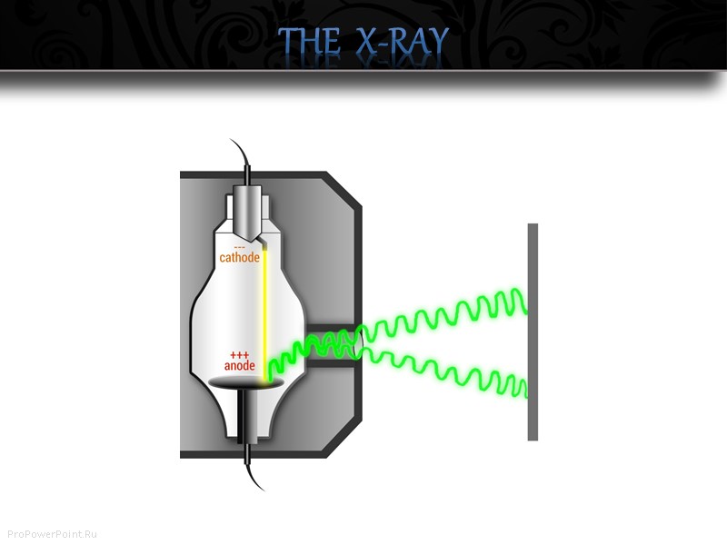 The  X-RAY